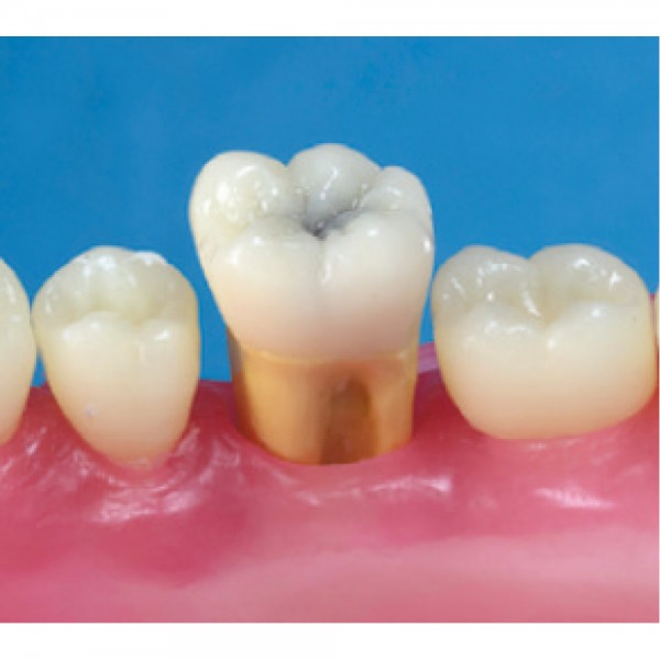 Radiopaque Endodontic Training Tooth, 46/LR6, First Molar