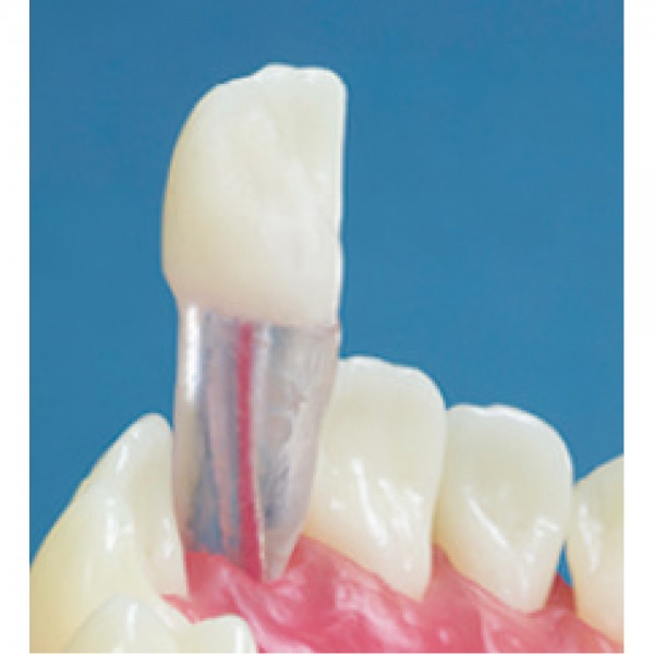 Transparent Endodontic Training Tooth, 11/UR1, Central Incisor