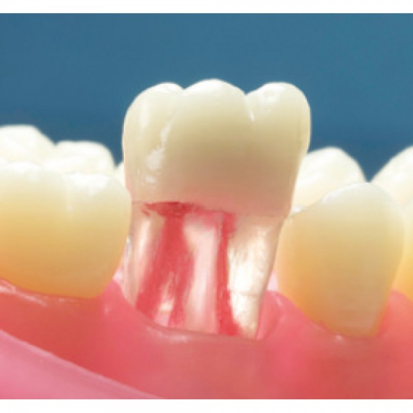 Transparent Endodontic Training Tooth, 46/LR6, First Molar