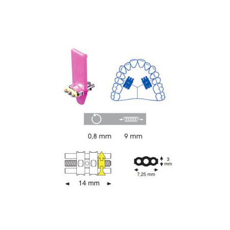 Orthodontic Medium Screw, 14 mm