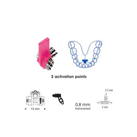 Three Directional Expansion Screw Anatomical For Lower Arch, 13mm