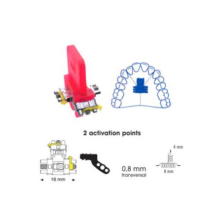 Three Directional Expansion Screw Anatomical, 16mm