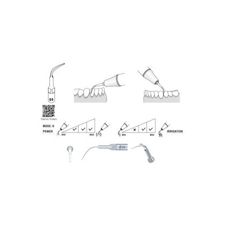 G4 Woodpecker Scaler Tip, Treatment of Interproximal Spaces and Supragingival Scaling