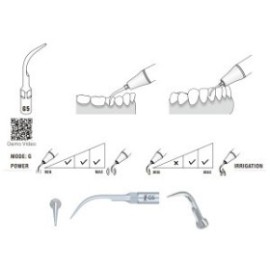 G5 Woodpecker Scaler Tip, Treating Simple Cases and Gross Supragingival Scaling