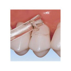 Cure-Thru Cervical Matrices Anterior Premolar 150/Bx