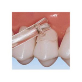 Cure-Thru Cervical Matrices Universal Molar 150/Bx