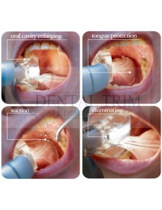 Intraoral Lighting System