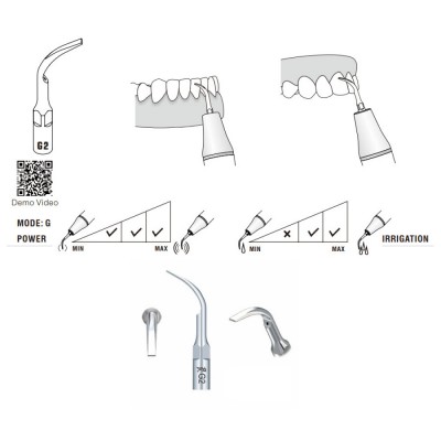 G2 Woodpecker Scaler Tip, Removal of Heavy Supragingival Deposits