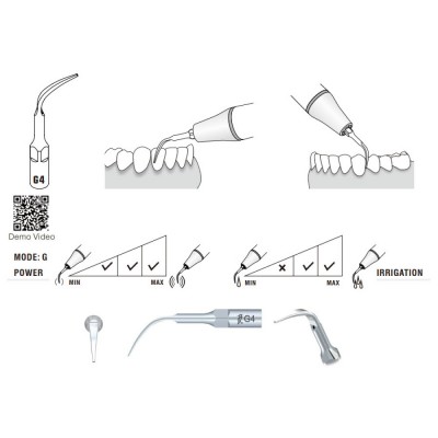 G4 Woodpecker Scaler Tip, Treatment of Interproximal Spaces and Supragingival Scaling